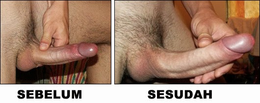 sebelum dan sesudah menggunakan vimax